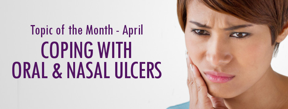 nasal ulcers lupus