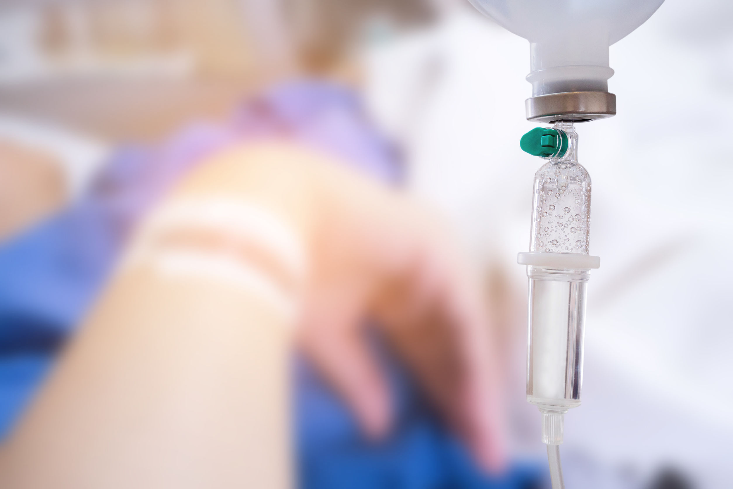 What You Should Know About Infusion Therapy for Lupus